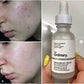 The Ordinary Niacinamide 10% + Zinc 1% – 30ml by Click N Buy